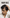 Hairfall